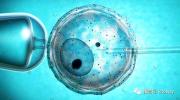 医疗胚胎管理应用