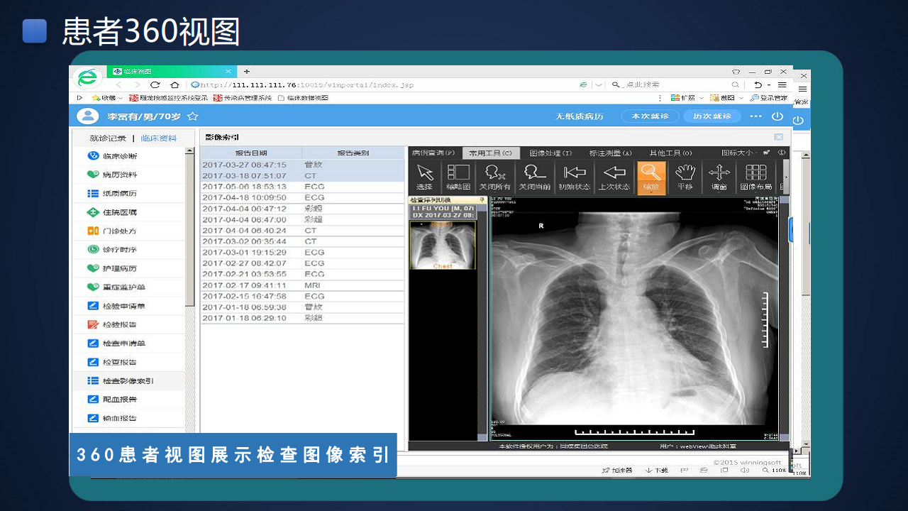 智慧医院信息化建设方案图片